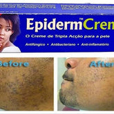 Epiderm Fast Action Crème 1oz/30g 3pcs Epiderm